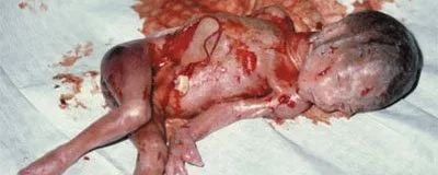 O criminoso Estado: 16 mil assassínios anuais em nome de um “direito”